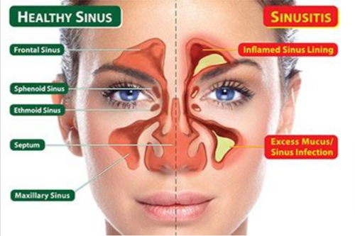 healthy sinus and normal sinus explain work