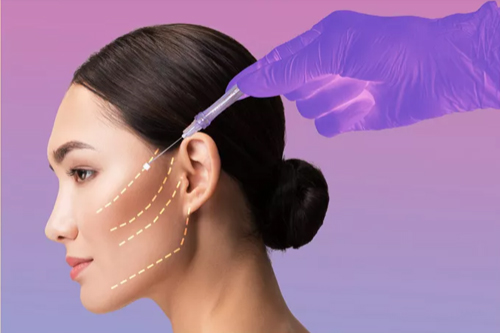 Thread Lift mark tightening skin on face